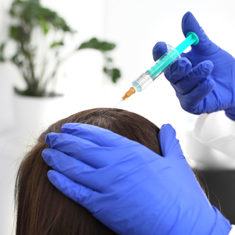 Mesotheraphie Cheveux Lille - L'esthetic Clinic